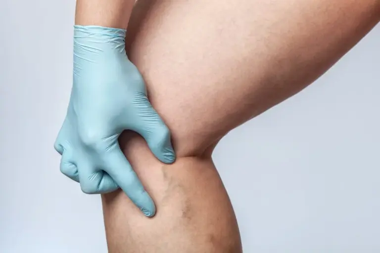 Vitamins Help Ischemia Heart Disease: Top List