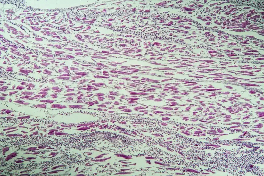 Key Cardiomyopathy Exclusion Diagnostic Methods