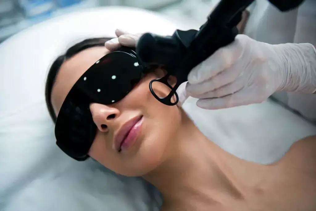 How to Remove Facial Scars with Laser Treatment 2 How to Remove Facial Scars with Laser Treatment