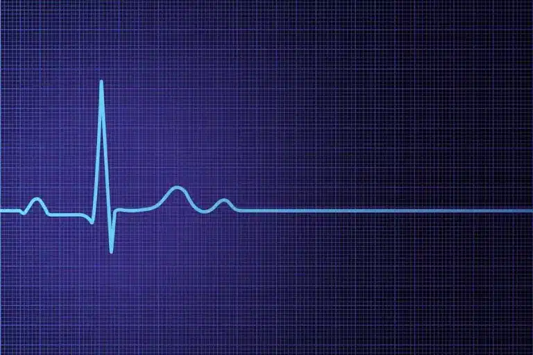 Best Atrial Fibrillation Episode Positioning