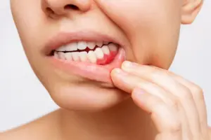 Warning: Dental Infection Endocarditis Risk Connection