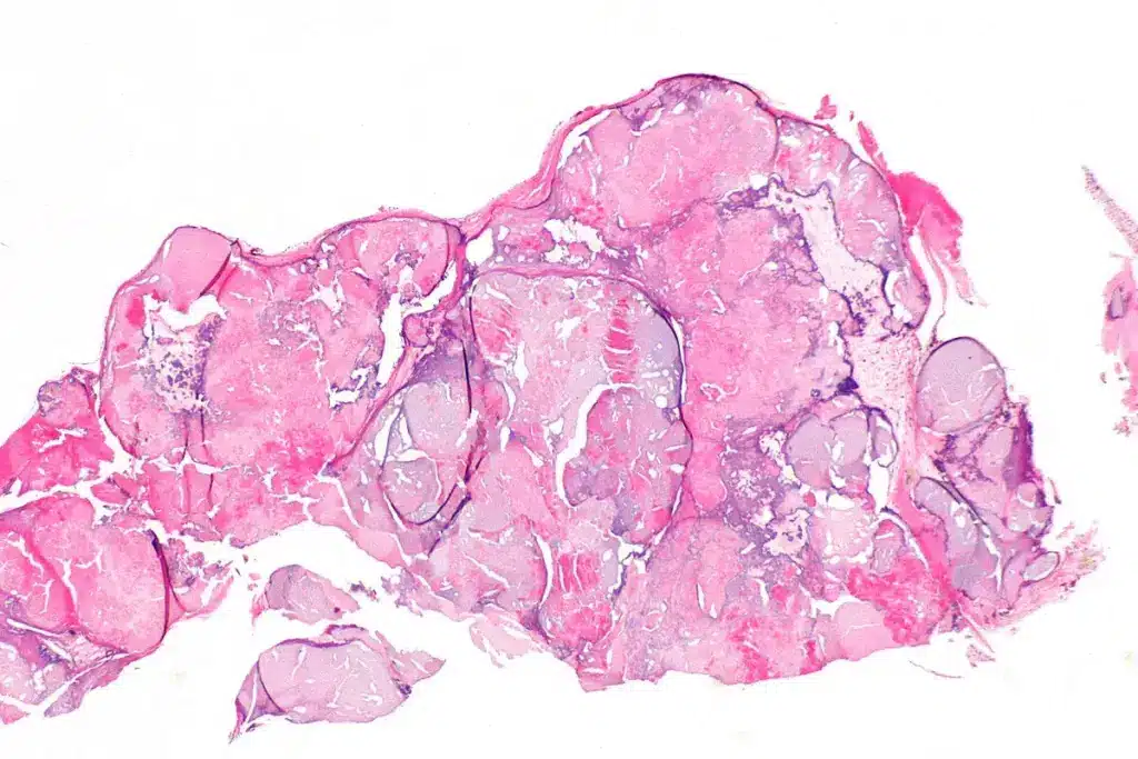 image 2 1034 LIV Hospital