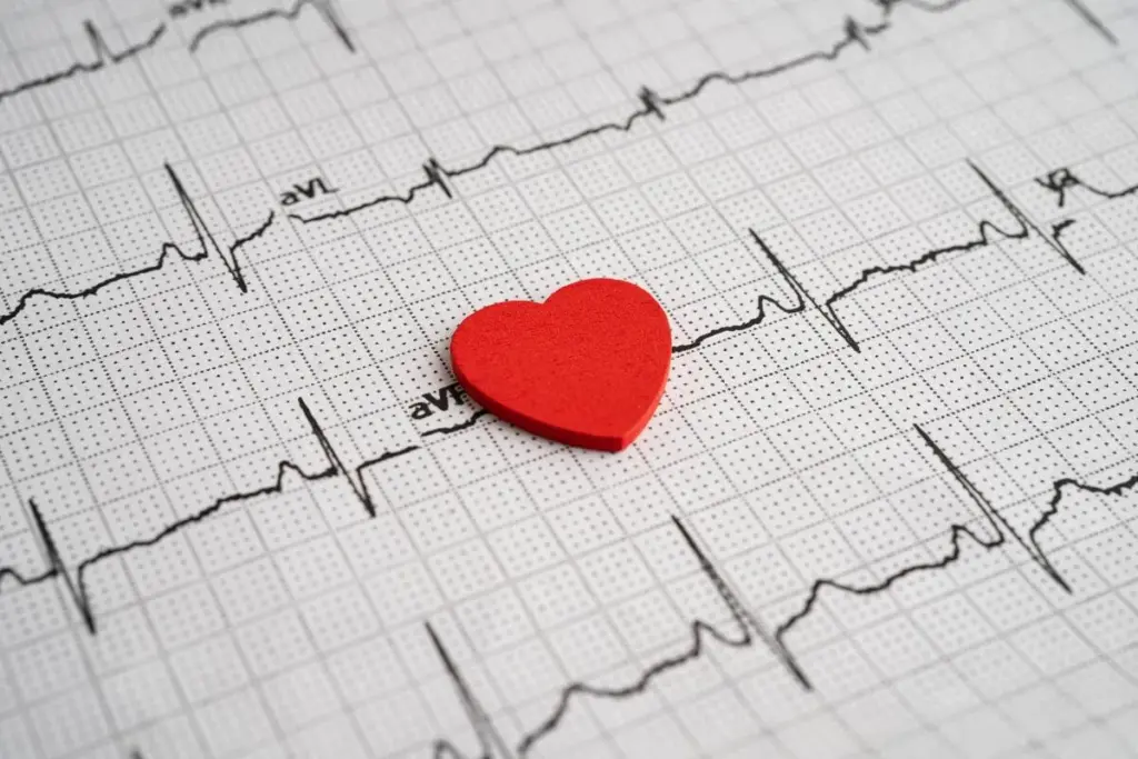 Effective Arrhythmia Treatment Methods Explained