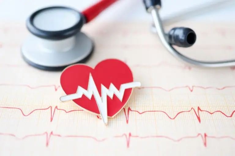 Positive Arrhythmia Life Expectancy Prognosis