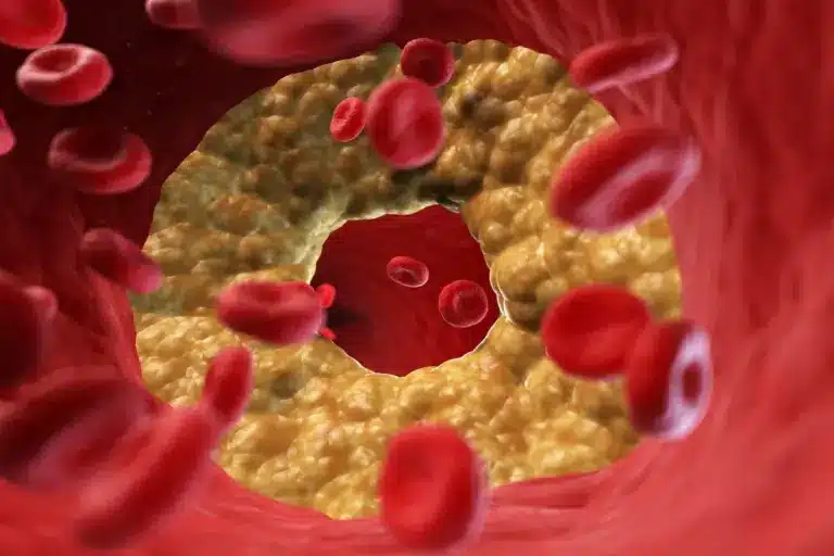 Effective Valvular Disease Pharmaceutical Treatment