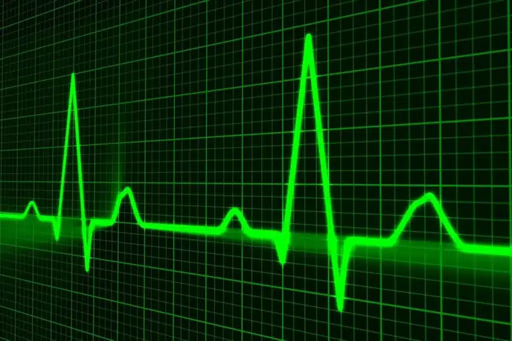 Key Ablation Versus Pacemaker Comparison