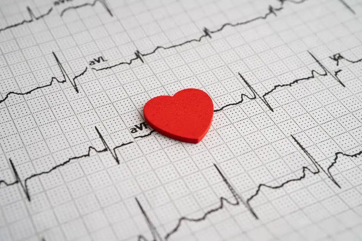 Key Arrhythmia Life Expectancy Impact Assessment