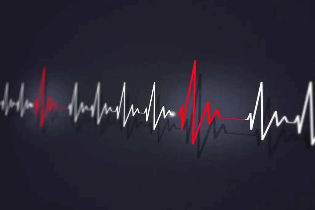 Key Arrhythmia Life Expectancy Impact Assessment