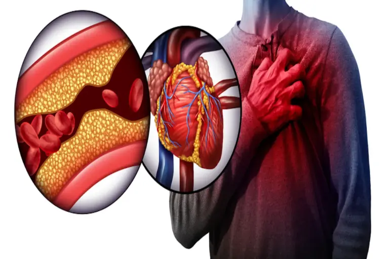 Warning: Top Arterial Blockage Symptoms You Need to Know