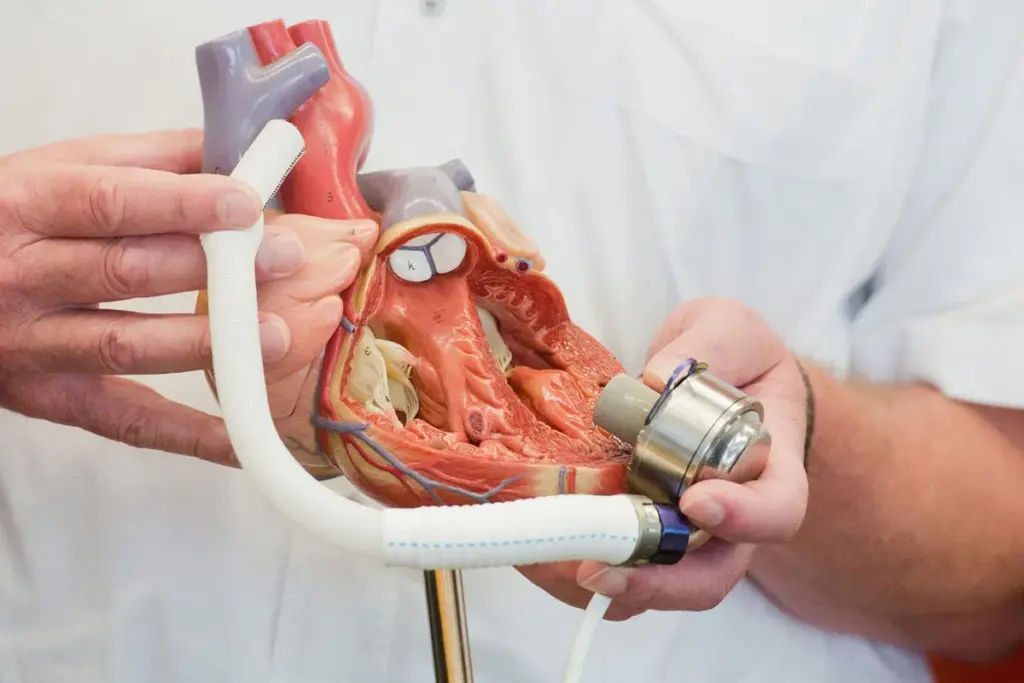 Open Heart Surgery Survival: The Amazing Odds Fact Revealed