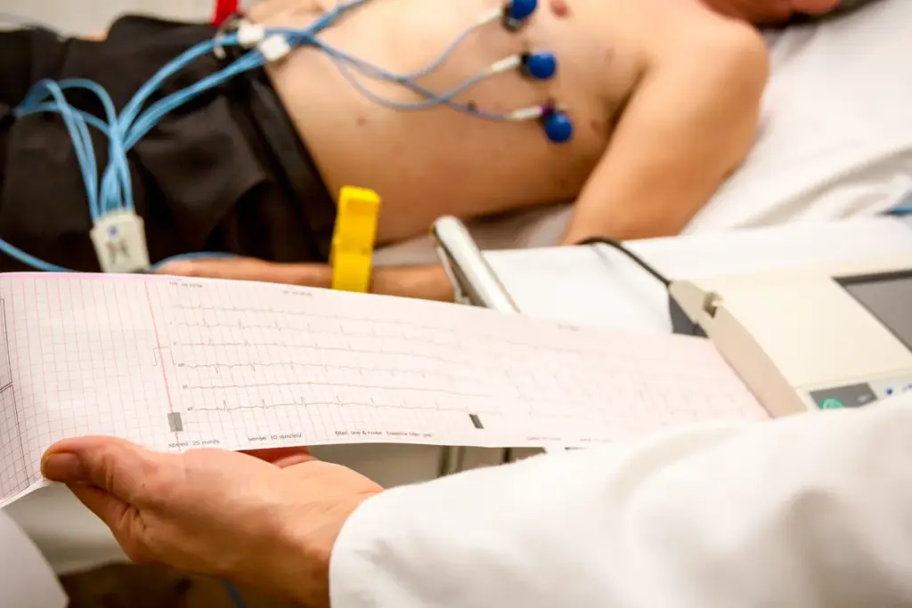 EKG For Heart Defects: The Crucial Role in Diagnosis Today