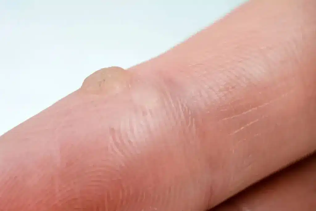 image 3 812 LIV Hospital