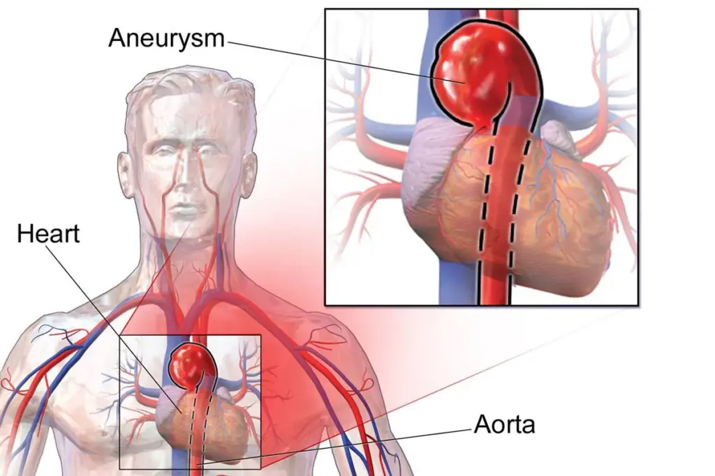 Aorta: The Crucial Location of this Amazing Artery