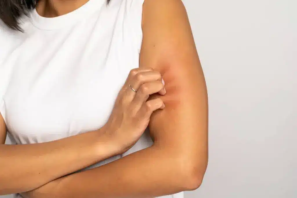 Amazing What Does 0 Mean On An Allergy Test (RAST Test)? 1 Amazing What Does 0 Mean On An Allergy Test (RAST Test)?