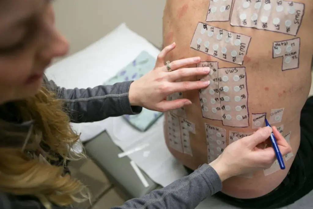 Profound Is Patch Testing Painful: Skin Allergy Test Pain 3 image 3 702 LIV Hospital