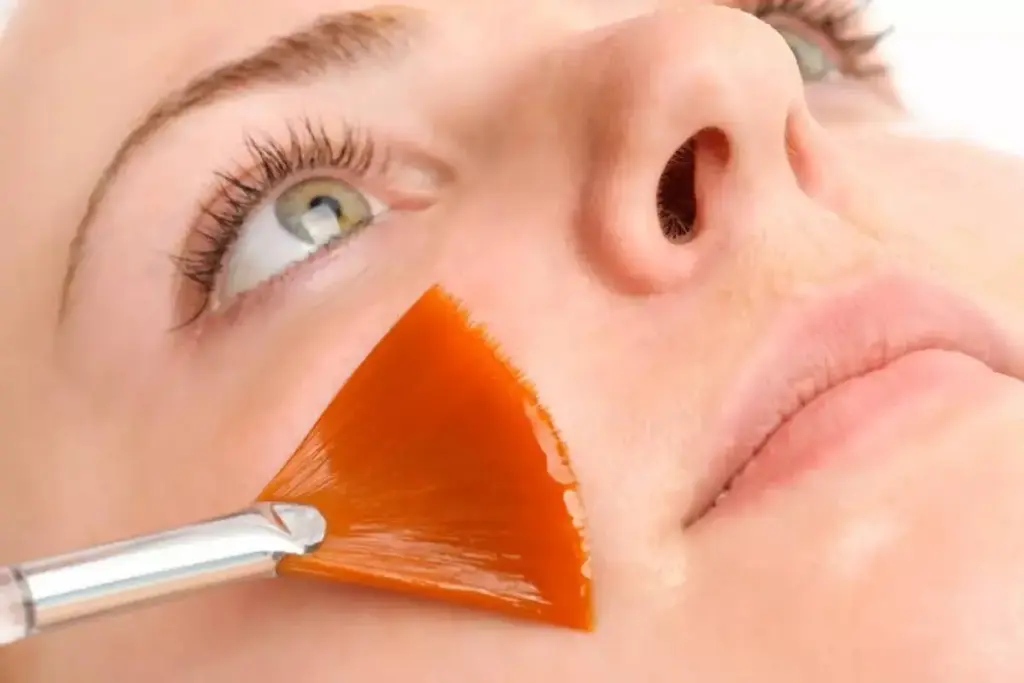 Profound Are Chemical Peels Worth The Hype: Expert Opinion