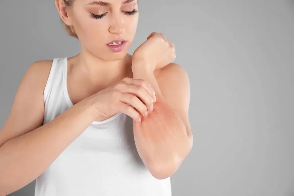 Low Histamine Diet: Crucial Negative Foods to Avoid Now