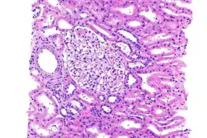 Essential How Are Cancer Cells Different From Normal Cells