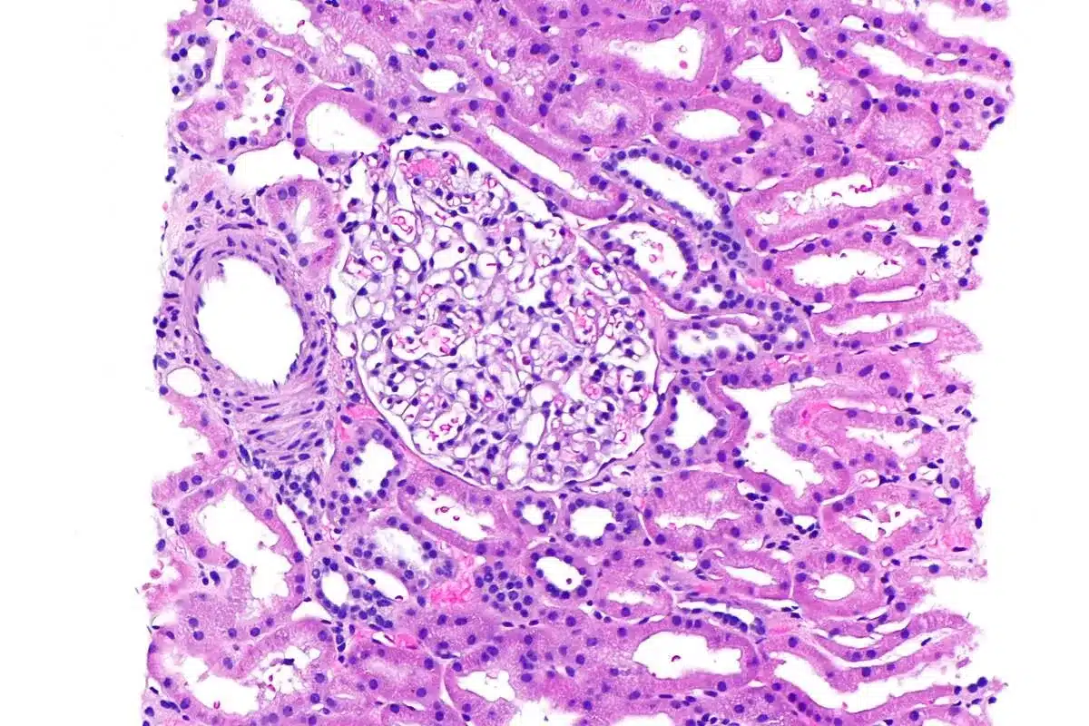 Essential How Are Cancer Cells Different From Normal Cells