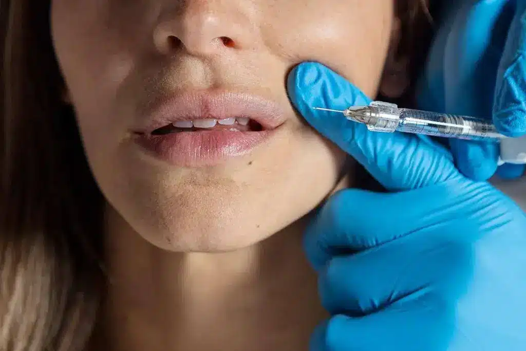 Essential What's The Longest Botox Will Last: Guide