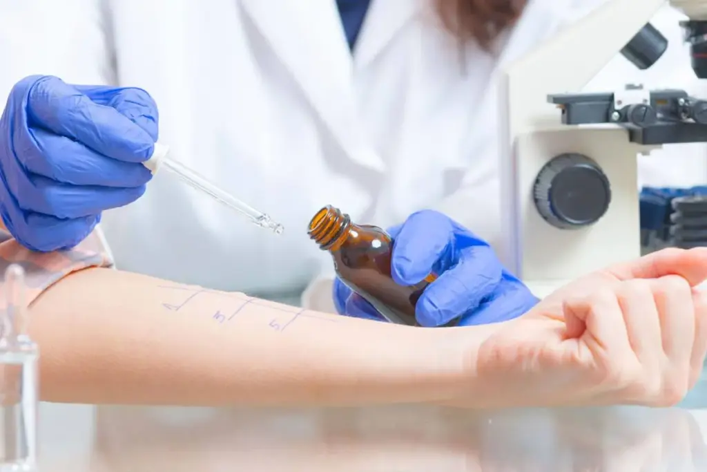 Guide Do Pharmacies Do Allergy Tests (Allergy Screening)?