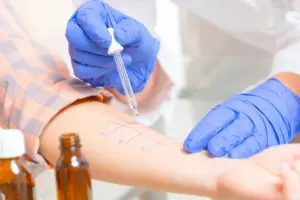 Profound What Does 100 Mean On An Allergy Test (Food Allergy Testing)?