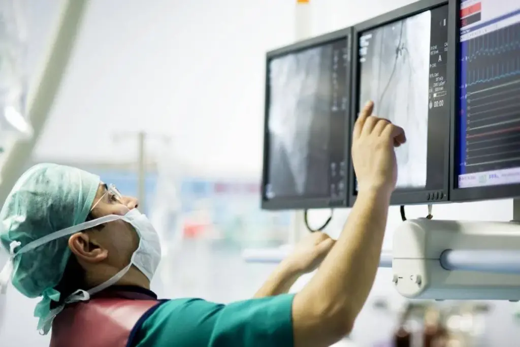 Amazing Do Cardiologists Performing Angioplasty?