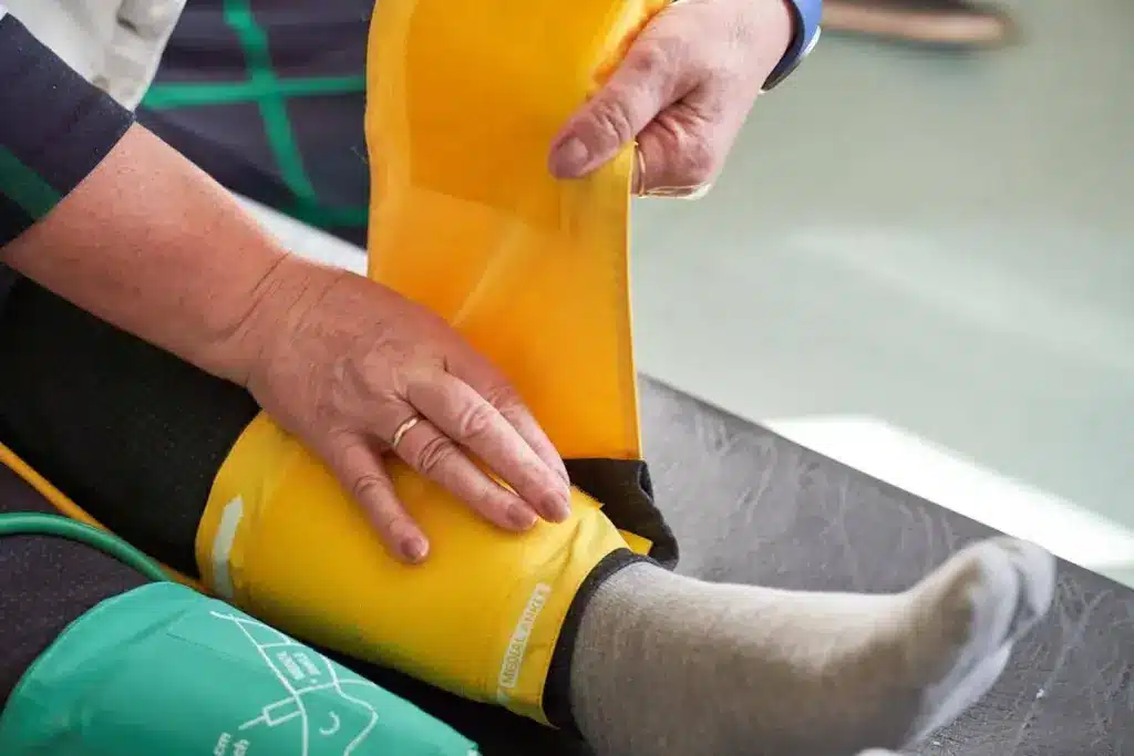 Insightful Why Do They Put Stents In Your Legs Stent Placement Reasons