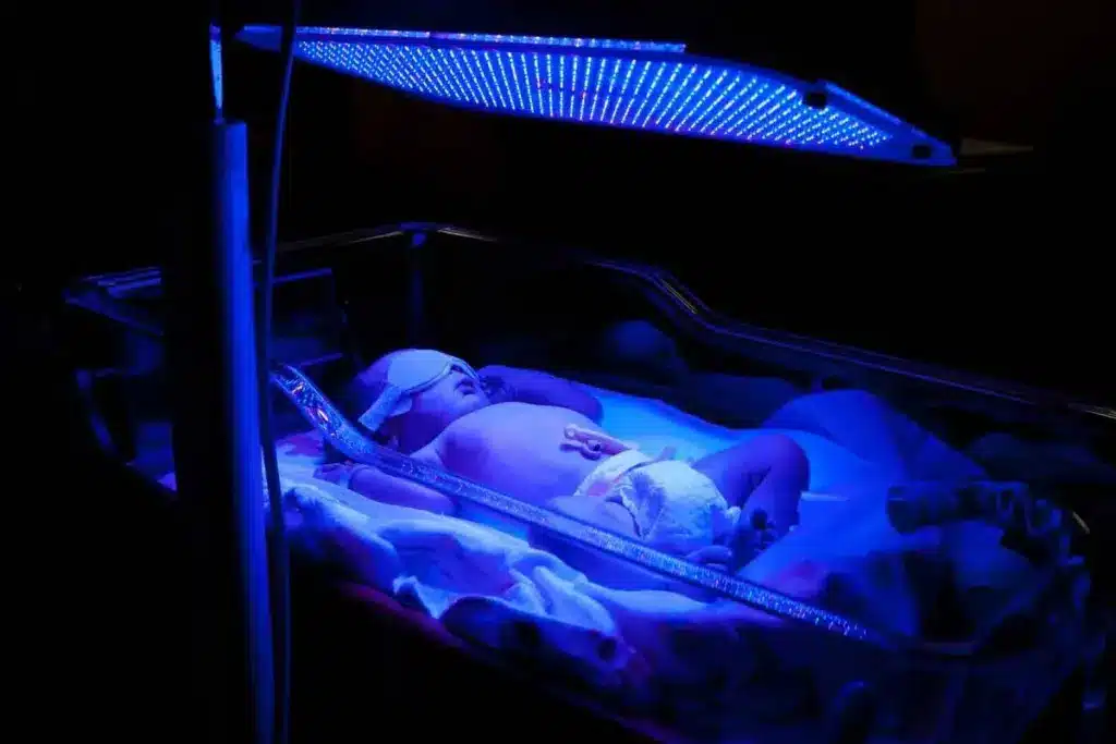 Valuable Who Is At High Risk For Jaundice In Newborns? 2 image 2 522 LIV Hospital
