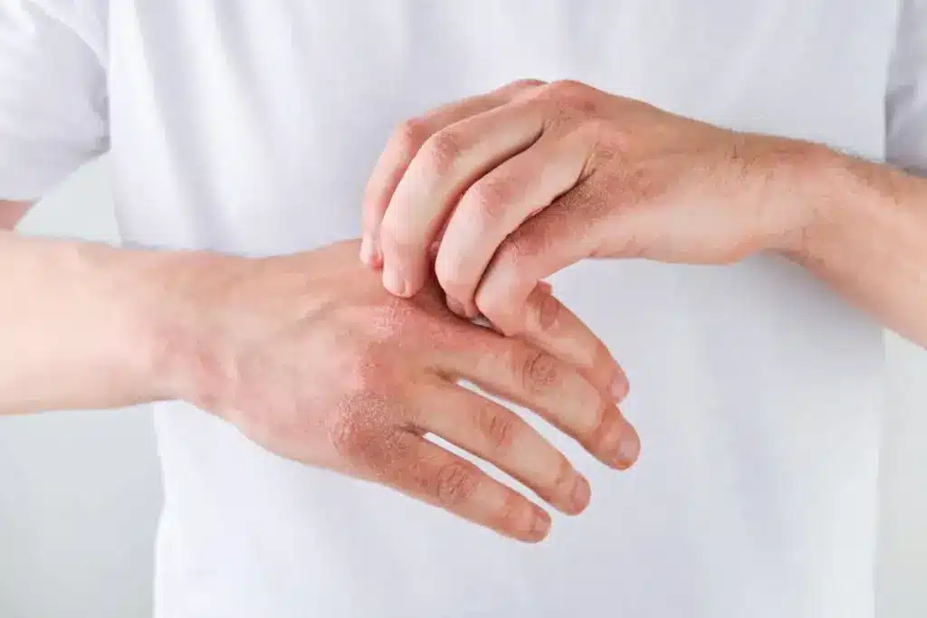 image 3 476 LIV Hospital