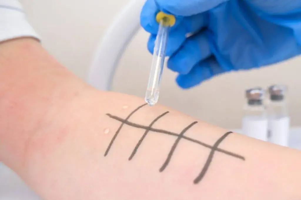 Guide How Much Does A Skin Patch Allergy Test Cost: Guide