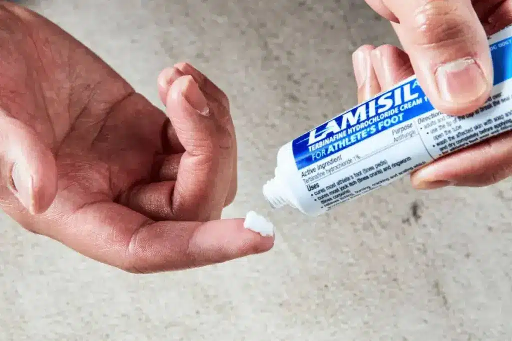 Complete What Kills Fungus Completely (Antifungal Cream)? 1 Complete What Kills Fungus Completely (Antifungal Cream)?