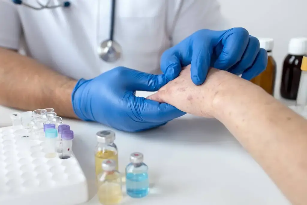 Amazing How To Test For Fungal Infection On Skin