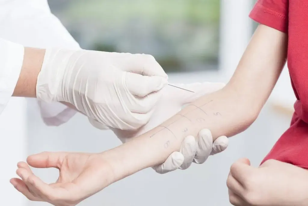 Insightful Which Part Of The Body Is Best For A Patch Test?