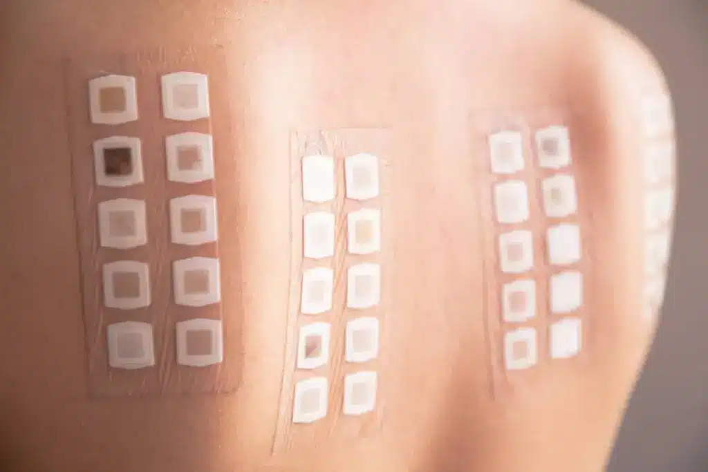 Insightful Which Part Of The Body Is Best For A Patch Test?