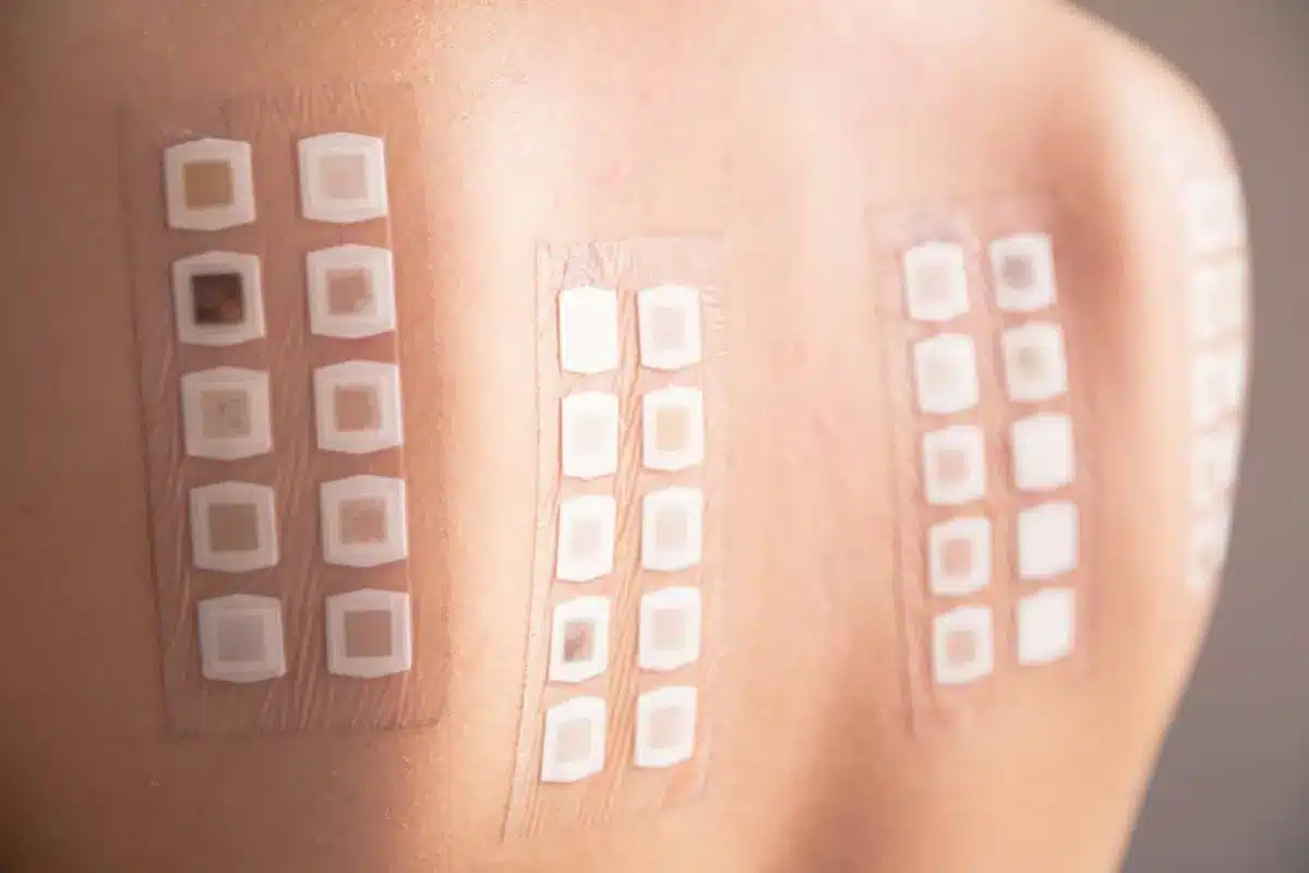 Insightful Which Part Of The Body Is Best For A Patch Test?