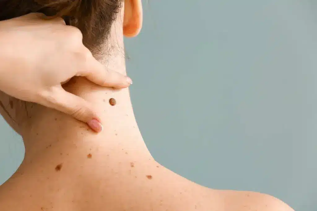 image 3 377 LIV Hospital