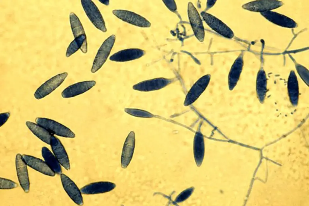 Sharp How Do You Starve Fungus In Your Body (Candida Overgrowth)?