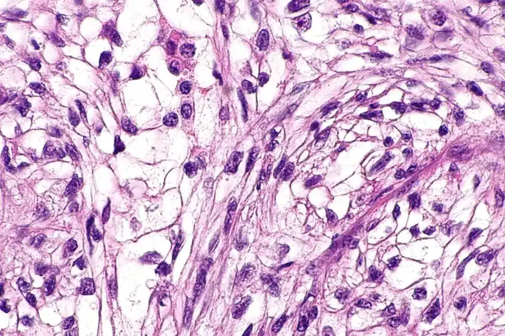 Key Can I Shower After A Skin Biopsy (Shave Biopsy)? 1 Key Can I Shower After A Skin Biopsy (Shave Biopsy)?