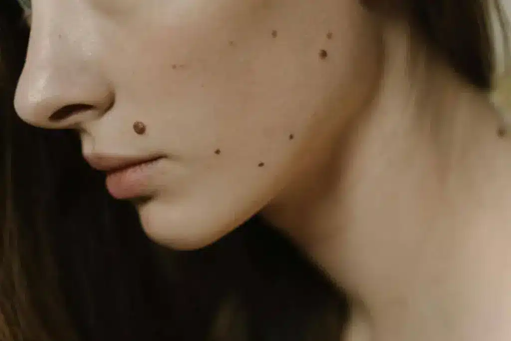 Amazing how Long Does It Take To Get Blood Work Back?