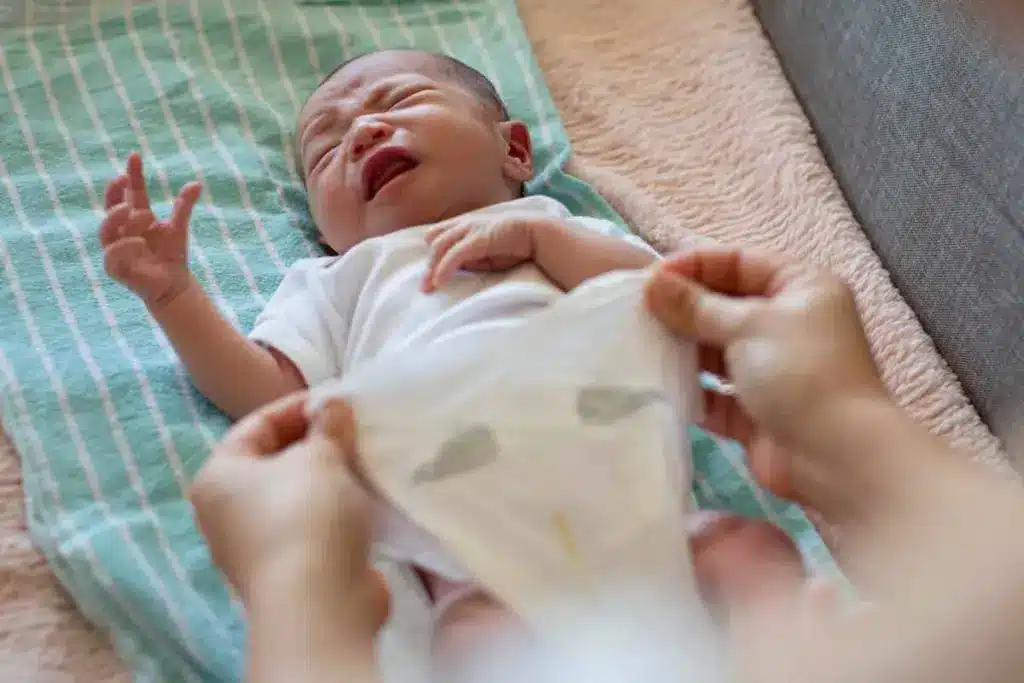 Guide Treat Fungus On Baby Skin: Diaper Rash Insights