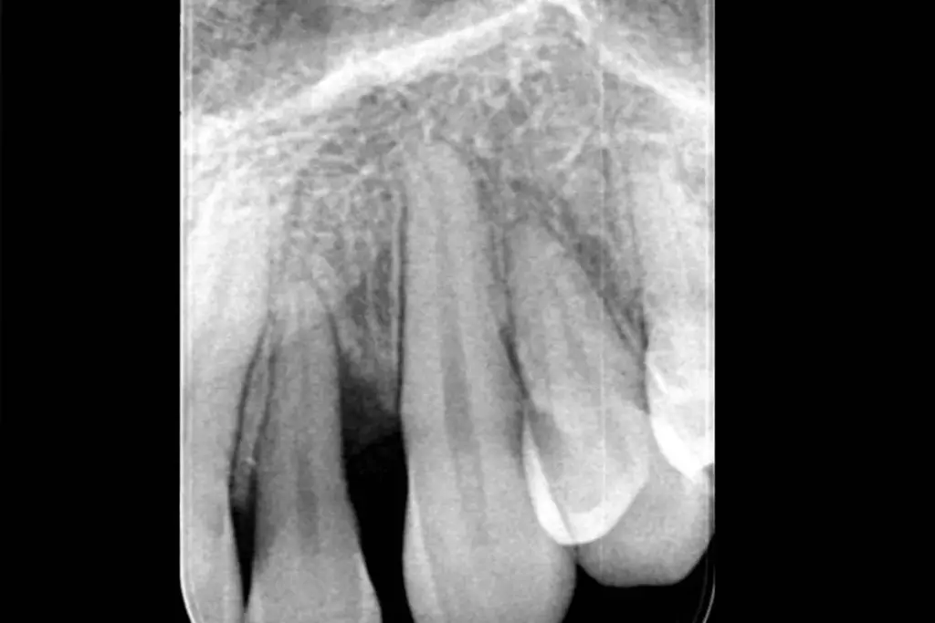 Common Ventricular Defect: The Crucial Most Frequent Issue