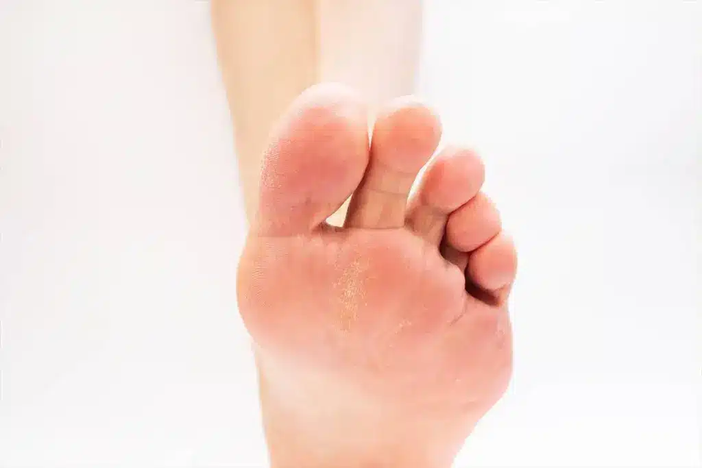 Insightful Symptoms Of Too Much Yeast Infection In Your Body