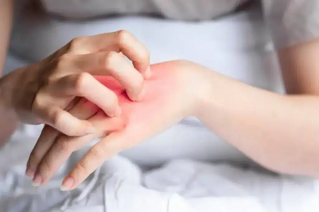 Essential What Damage Does Fungal Infection Do To Body?