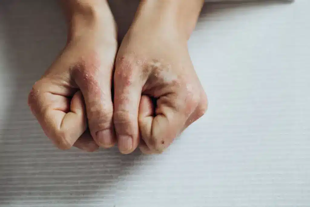 image 1 242 LIV Hospital