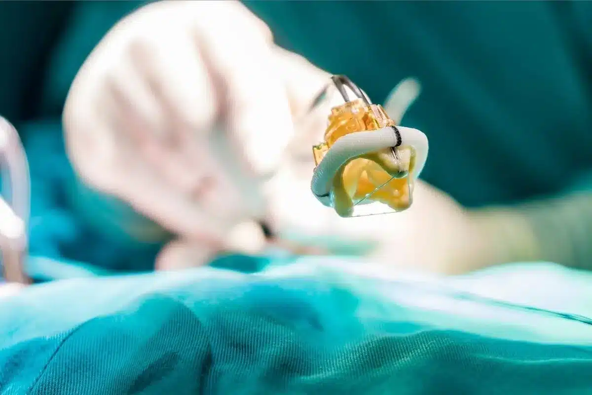 What Is Downside Of TAVR: Crucial Negative Risks Revealed