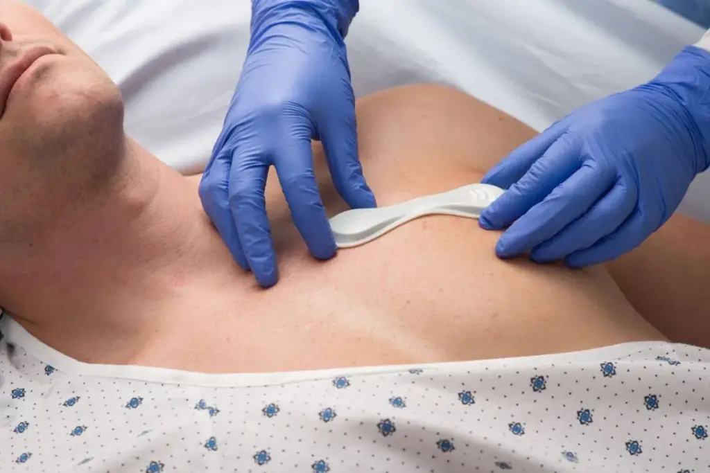 What Is Transcatheter Aortic Valve: The Crucial Device Fact 3 What Is Transcatheter Aortic Valve: The Crucial Device Fact