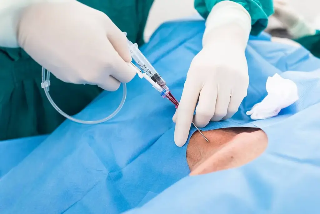 Do You Go To ICU After TAVR: The Crucial Post-Op Fact 3 Do You Go To ICU After TAVR: The Crucial Post-Op Fact