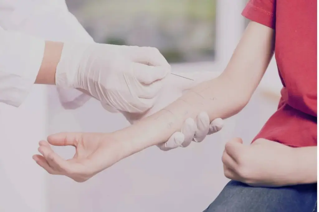 Key Gold Standard For Allergy Testing (Food Sensitivity Test)?