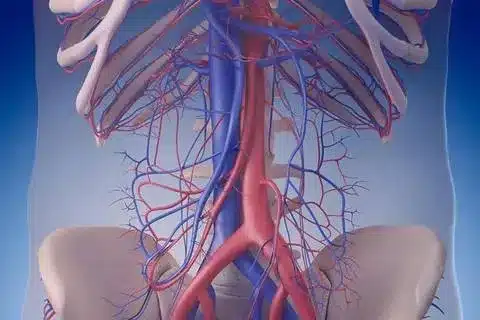 Stress Aneurysm: Can Crucial Stress Cause Growth? Negative Link